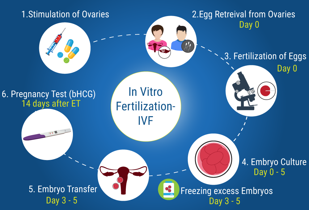 IVF Cost France