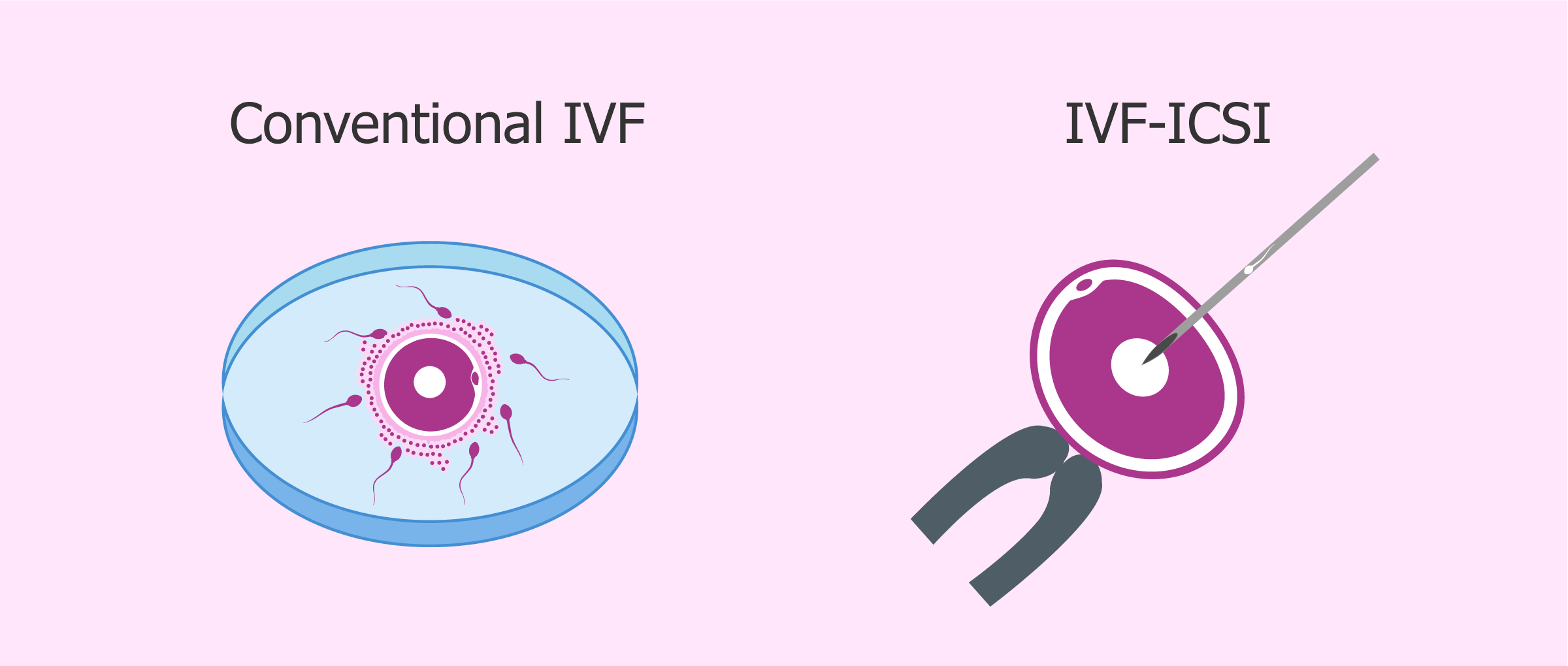 How is ICSI different from IVF