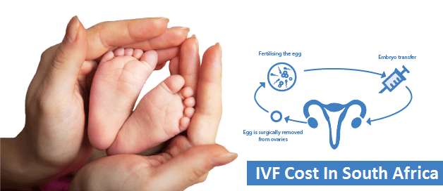 IVF Cost in South Africa 2019