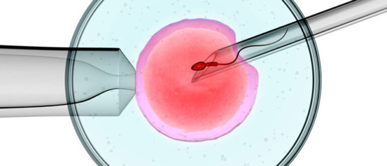 IMSI in Ukraine Male Fertility